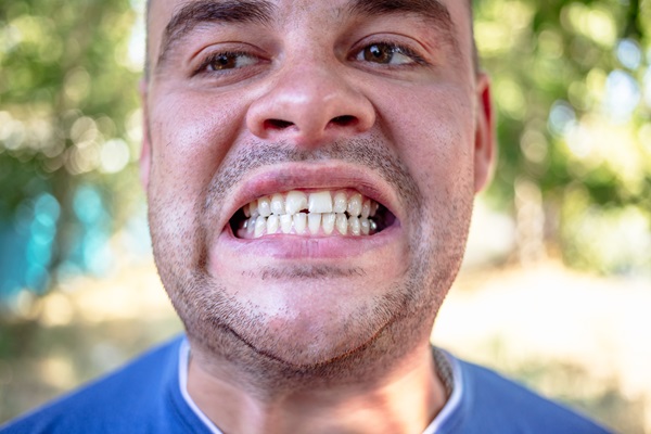 What To Do When You Have A Broken Tooth: Expert Dental Advice